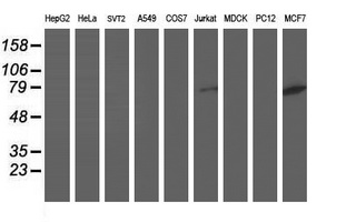 Dipeptidyl Peptidase 3 / DPP3 Antibody - Western blot of extracts (35ug) from 9 different cell lines by using anti-DPP3 monoclonal antibody.