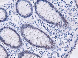 Dipeptidyl Peptidase 3 / DPP3 Antibody - IHC of paraffin-embedded Human colon tissue using anti-DPP3 mouse monoclonal antibody. (Heat-induced epitope retrieval by 10mM citric buffer, pH6.0, 100C for 10min).