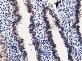 Dipeptidyl Peptidase 3 / DPP3 Antibody - IHC of paraffin-embedded Human endometrium tissue using anti-DPP3 mouse monoclonal antibody. (Heat-induced epitope retrieval by 10mM citric buffer, pH6.0, 100C for 10min).