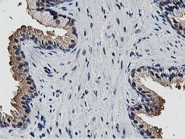 Dipeptidyl Peptidase 3 / DPP3 Antibody - IHC of paraffin-embedded Human prostate tissue using anti-DPP3 mouse monoclonal antibody. (Heat-induced epitope retrieval by 10mM citric buffer, pH6.0, 100C for 10min).