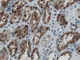 Dipeptidyl Peptidase 3 / DPP3 Antibody - IHC of paraffin-embedded Human Kidney tissue using anti-DPP3 mouse monoclonal antibody. (Heat-induced epitope retrieval by 10mM citric buffer, pH6.0, 100C for 10min).