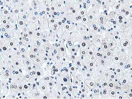 Dipeptidyl Peptidase 3 / DPP3 Antibody - IHC of paraffin-embedded Human liver tissue using anti-DPP3 mouse monoclonal antibody. (Heat-induced epitope retrieval by 10mM citric buffer, pH6.0, 100C for 10min).