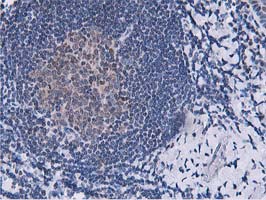 Dipeptidyl Peptidase 3 / DPP3 Antibody - IHC of paraffin-embedded Human lymph node tissue using anti-DPP3 mouse monoclonal antibody. (Heat-induced epitope retrieval by 10mM citric buffer, pH6.0, 100C for 10min).