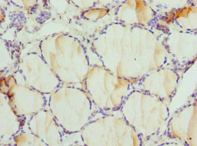 Dipeptidyl Peptidase 3 / DPP3 Antibody - Immunohistochemistry of paraffin-embedded human thyroid tissue at dilution 1:100