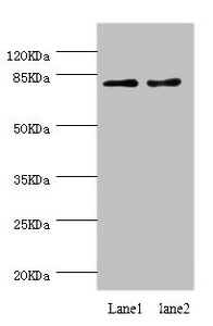 Dipeptidyl Peptidase 3 / DPP3 Antibody - Western blot All Lanes:DPP3 antibody at 1.39ug/ml Lane 1:MCF-7 whole cell lysate Lane 2:HT29 whole cell lysate Secondary Goat polyclonal to rabbit at 1/10000 dilution Predicted band size: 83,36,70,80 kDa Observed band size: 83 kDa