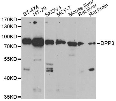 Dipeptidyl Peptidase 3 / DPP3 Antibody - Western blot analysis of extracts of various cell lines, using DPP3 antibody at 1:1000 dilution. The secondary antibody used was an HRP Goat Anti-Rabbit IgG (H+L) at 1:10000 dilution. Lysates were loaded 25ug per lane and 3% nonfat dry milk in TBST was used for blocking. An ECL Kit was used for detection and the exposure time was 90s.