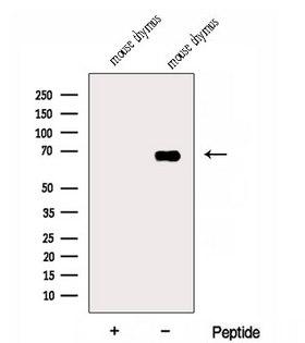 Dipeptidyl Peptidase 3 / DPP3 Antibody - Western blot analysis of extracts of mouse thymus tissue using DPP3 antibody. The lane on the left was treated with blocking peptide.
