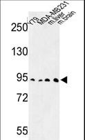 Dipeptidylpeptidase 10 / DPP10 Antibody - Western blot of DPP10 Antibody in Y79, MDA-MB231 cell line and mouse liver, brain tissue lysates (35 ug/lane). DPP10 (arrow) was detected using the purified antibody.