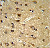 Dipeptidylpeptidase 10 / DPP10 Antibody - DPP10 Antibody IHC of formalin-fixed and paraffin-embedded brain tissue followed by peroxidase-conjugated secondary antibody and DAB staining.