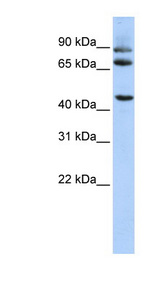 Dipeptidylpeptidase 10 / DPP10 Antibody - DPP10 antibody Western blot of HepG2 cell lysate. This image was taken for the unconjugated form of this product. Other forms have not been tested.