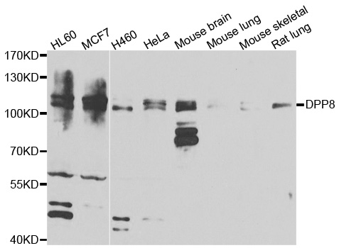 Dipeptidylpeptidase 8 / DPP8 Antibody - Western blot analysis of extracts of various cell lines.