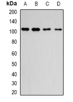 Dipeptidylpeptidase 8 / DPP8 Antibody - Western blot analysis of DPP8 expression in MCF7 (A); HeLa (B); mouse brain (C); rat lung (D) whole cell lysates.