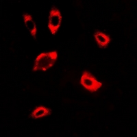 Dipeptidylpeptidase 8 / DPP8 Antibody - Immunofluorescent analysis of DPP8 staining in A549 cells. Formalin-fixed cells were permeabilized with 0.1% Triton X-100 in TBS for 5-10 minutes and blocked with 3% BSA-PBS for 30 minutes at room temperature. Cells were probed with the primary antibody in 3% BSA-PBS and incubated overnight at 4 deg C in a humidified chamber. Cells were washed with PBST and incubated with a DyLight 594-conjugated secondary antibody (red) in PBS at room temperature in the dark.
