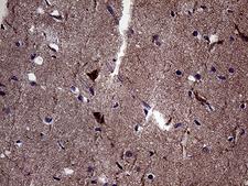 DIRAS2 Antibody - Immunohistochemical staining of paraffin-embedded Human adult brain tissue within the normal limits using anti-DIRAS2 mouse monoclonal antibody. (Heat-induced epitope retrieval by 1mM EDTA in 10mM Tris buffer. (pH8.5) at 120 oC for 3 min. (1:2000)