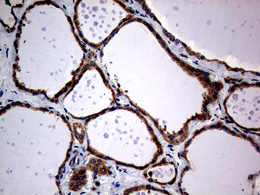 DIRAS2 Antibody - Immunohistochemical staining of paraffin-embedded Human thyroid tissue within the normal limits using anti-DIRAS2 mouse monoclonal antibody. (Heat-induced epitope retrieval by 1mM EDTA in 10mM Tris buffer. (pH8.5) at 120°C for 3 min. (1:150)