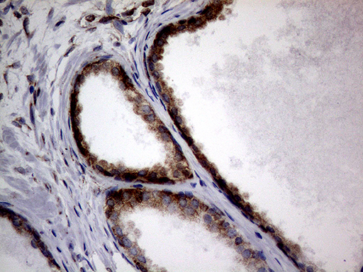 DIRAS2 Antibody - Immunohistochemical staining of paraffin-embedded Human prostate tissue within the normal limits using anti-DIRAS2 mouse monoclonal antibody. (Heat-induced epitope retrieval by 1mM EDTA in 10mM Tris buffer. (pH8.5) at 120°C for 3 min. (1:150)