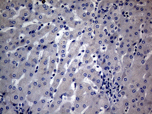 DIRAS2 Antibody - Immunohistochemical staining of paraffin-embedded Human liver tissue within the normal limits using anti-DIRAS2 mouse monoclonal antibody.This figure shows negative staining. (Heat-induced epitope retrieval by 1mM EDTA in 10mM Tris buffer. (pH8.5) at 120°C for 3 min. (1:150)