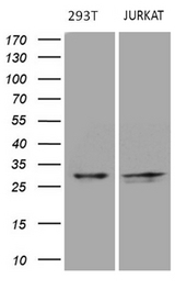 DIRAS2 Antibody - Western blot analysis of extracts. (35ug) from 2 different cell lines by using anti-DIRAS2 monoclonal antibody. (293T: human; Jurkat: human;). (1:500)