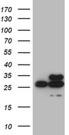 DIRAS2 Antibody - HEK293T cells were transfected with the pCMV6-ENTRY control. (Left lane) or pCMV6-ENTRY DIRAS2. (Right lane) cDNA for 48 hrs and lysed. Equivalent amounts of cell lysates. (5 ug per lane) were separated by SDS-PAGE and immunoblotted with anti-DIRAS2. (1:2000)