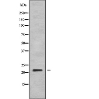 DIRAS2 Antibody - Western blot analysis of DIRAS2 using Jurkat whole cells lysates