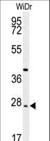 DIRAS3 / ARHI Antibody - DIRAS3 Antibody western blot of WiDr cell line lysates (35 ug/lane). The DIRAS3 antibody detected the DIRAS3 protein (arrow).