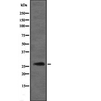 DIRAS3 / ARHI Antibody - Western blot analysis of DIRAS3 expression in 293 lysate. The lane on the left is treated with the antigen-specific peptide.