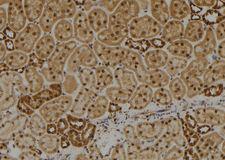 DIRC1 Antibody - 1:100 staining rat kidney tissue by IHC-P. The sample was formaldehyde fixed and a heat mediated antigen retrieval step in citrate buffer was performed. The sample was then blocked and incubated with the antibody for 1.5 hours at 22°C. An HRP conjugated goat anti-rabbit antibody was used as the secondary.