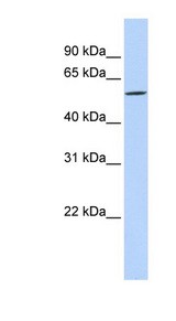 DIRC2 / RCC4 Antibody - DIRC2 antibody Western blot of MCF7 cell lysate. This image was taken for the unconjugated form of this product. Other forms have not been tested.