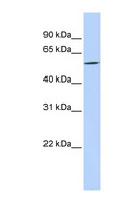 DIRC2 / RCC4 Antibody - DIRC2 antibody Western blot of MCF7 cell lysate. This image was taken for the unconjugated form of this product. Other forms have not been tested.