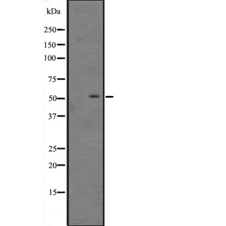 DIRC2 / RCC4 Antibody - Western blot analysis of DIRC2 expression in MCF-7 cells Lysate. The lane on the left is treated with the antigen-specific peptide.