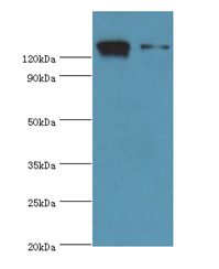 DIS / CCAR1 Antibody - Western blot. All lanes: CCAR1 antibody at 10 ug/ml. Lane 1: HeLa whole cell lysate. Lane 2: PC-3 whole cell lysate. Secondary antibody: Goat polyclonal to rabbit at 1:10000 dilution. Predicted band size: 133 kDa. Observed band size: 133 kDa Immunohistochemistry.