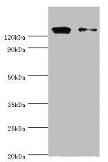 DIS / CCAR1 Antibody - Western blot All lanes: CCAR1 antibody at 10µg/ml Lane 1: Hela whole cell lysate Lane 2: PC-3 whole cell lysate Secondary Goat polyclonal to rabbit IgG at 1/10000 dilution Predicted band size: 133, 132 kDa Observed band size: 133 kDa