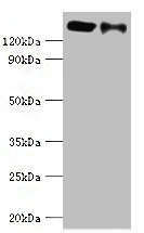 DIS / CCAR1 Antibody - Western blot All lanes: CCAR1 antibody at 8µg/ml Lane 1: Hela whole cell lysate Lane 2: PC-3 whole cell lysate Secondary Goat polyclonal to rabbit IgG at 1/10000 dilution Predicted band size: 133, 132 kDa Observed band size: 133 kDa