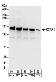 DIS / CCAR1 Antibody - Detection of Human and Mouse CCAR1 by Western Blot. Samples: Whole cell lysate (50 ug) from HeLa, 293T, Jurkat, mouse TCMK-1, and mouse NIH3T3 cells. Antibodies: Affinity purified rabbit anti-CCAR1 antibody used for WB at 0.1 ug/ml. Detection: Chemiluminescence with an exposure time of 10 seconds.