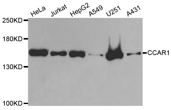 DIS / CCAR1 Antibody - Western blot analysis of extracts of various cell lines.