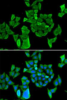 DIS / CCAR1 Antibody - Immunofluorescence analysis of HeLa cells.