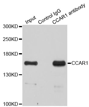 DIS / CCAR1 Antibody - Immunoprecipitation analysis of 200ug extracts of HeLa cells.