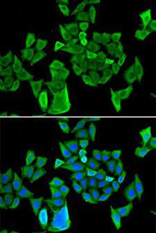 DIS / CCAR1 Antibody - Immunofluorescence analysis of HeLa cells using CCAR1 antibody. Blue: DAPI for nuclear staining.