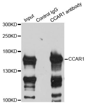 DIS / CCAR1 Antibody - Immunoprecipitation analysis of 200ug extracts of HeLa cells using 3ug CCAR1 antibody. Western blot was performed from the immunoprecipitate using CCAR1 antibody at a dilition of 1:500.