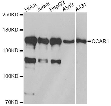 DIS / CCAR1 Antibody - Western blot analysis of extracts of various cell lines, using CCAR1 antibody at 1:1000 dilution. The secondary antibody used was an HRP Goat Anti-Rabbit IgG (H+L) at 1:10000 dilution. Lysates were loaded 25ug per lane and 3% nonfat dry milk in TBST was used for blocking. An ECL Kit was used for detection and the exposure time was 5s.