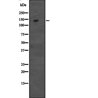DIS / CCAR1 Antibody - Western blot analysis of CCAR1 expression in HeLa cells lysate. The lane on the left is treated with the antigen-specific peptide.