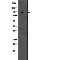DIS / CCAR1 Antibody - Western blot analysis of CCAR1 expression in HeLa cells lysate. The lane on the left is treated with the antigen-specific peptide.