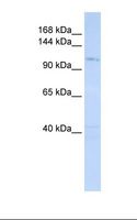 DIS3 Antibody - 721_B cell lysate. Antibody concentration: 1.0 ug/ml. Gel concentration: 6-18%.  This image was taken for the unconjugated form of this product. Other forms have not been tested.