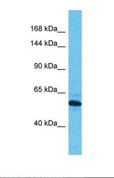 DIS3 Antibody - Western blot of Human Esophagus Tumor. DIS3 antibody dilution 1.0 ug/ml.  This image was taken for the unconjugated form of this product. Other forms have not been tested.