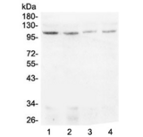 DIS3 Antibody - Western blot testing of human 1) HeLa, 2) HEK293, 3) MDA-MB-231 and 4) Caco-2 lysate with DIS3 antibody at 0.5ug/ml. Predicted molecular weight ~109 kDa.