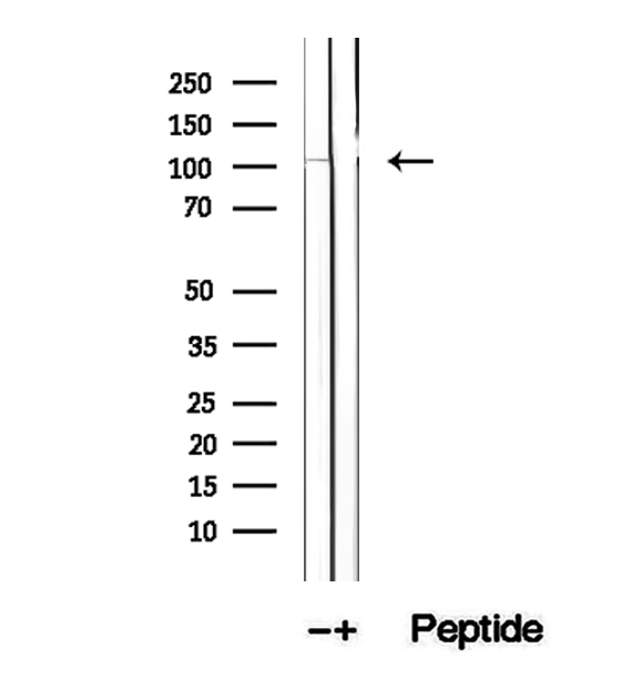 DIS3 Antibody - Western blot analysis of extracts of mouse testis tissue using DIS3 antibody.