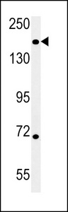 DIS3L Antibody - DI3L1 Antibody western blot of mouse heart tissue lysates (15 ug/lane). The DI3L1 antibody detected DI3L1 protein (arrow).