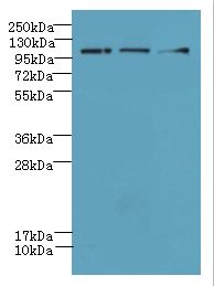 DIS3L Antibody - Western blot. All lanes: DIS3L antibody at 6 ug/ml. Lane 1: HeLa whole cell lysate. Lane 2: HepG-2 whole cell lysate. Lane 3: MCF7 whole cell lysate. Secondary Goat polyclonal to Rabbit IgG at 1:10000 dilution. Predicted band size: 121 kDa. Observed band size: 121 kDa.