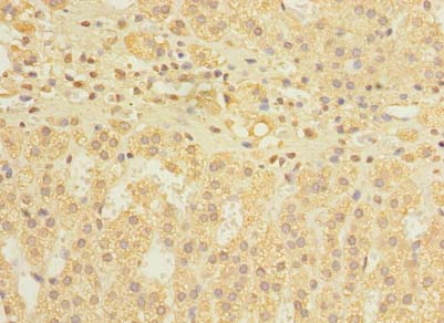 DIS3L Antibody - Immunohistochemistry of paraffin-embedded human adrenal gland tissue using antibody at dilution of 1:100.