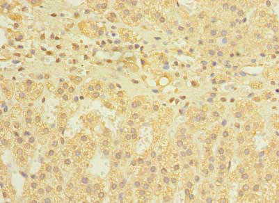 DIS3L Antibody - Immunohistochemistry of paraffin-embedded human adrenal gland tissue using DIS3L Antibody at dilution of 1:100